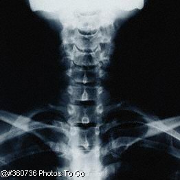 X-ray image of neck