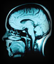 cat-scan.jpg